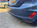 Ford Fiesta Titanium X 1.0i 100ps Automatic registration number:FY21XRX Pic ID:15
